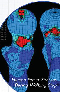 Human Femur Stresses During Walking Step